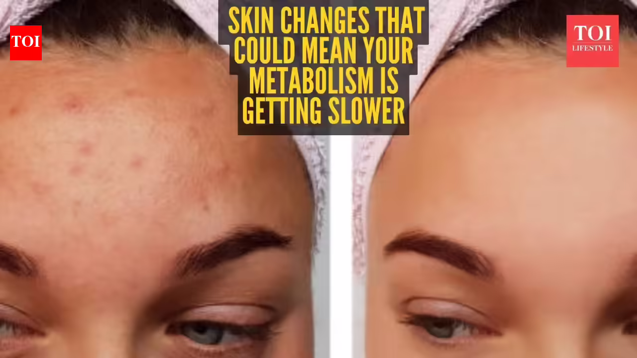 5 skin signs that your Metabolism is slowing down